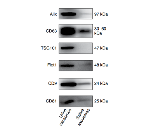 Western Blot蛋白免疫印迹分析
